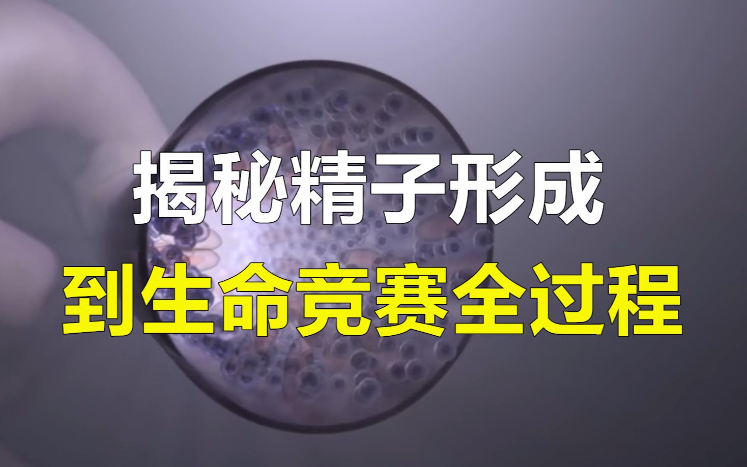 [图]揭秘精子形成到生命竞赛全过程，想拿第一不仅要跑得快还要运气好