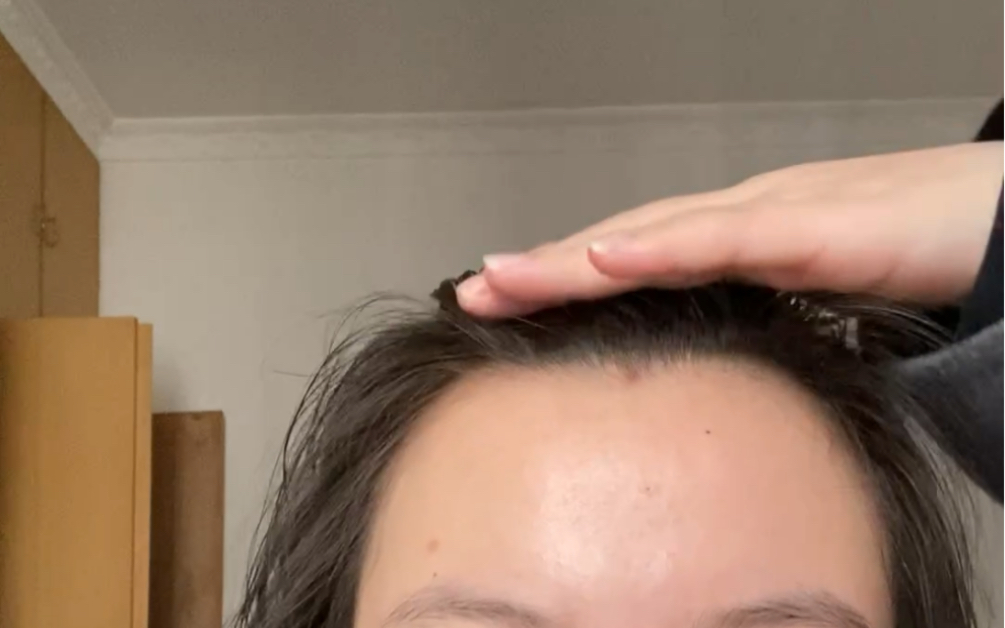 谁懂细软塌的痛啊 头顶 像被人拿铲子铲平了一样 有托尼能解决这个