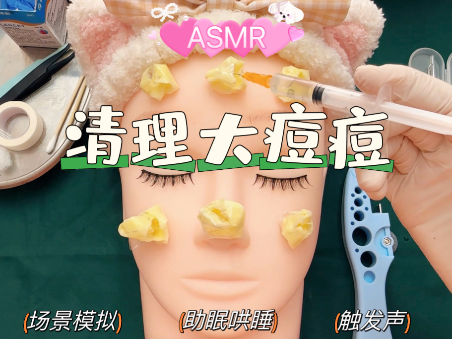 沉浸式为你清理大痘痘,ASMR场景模拟助眠哔哩哔哩bilibili