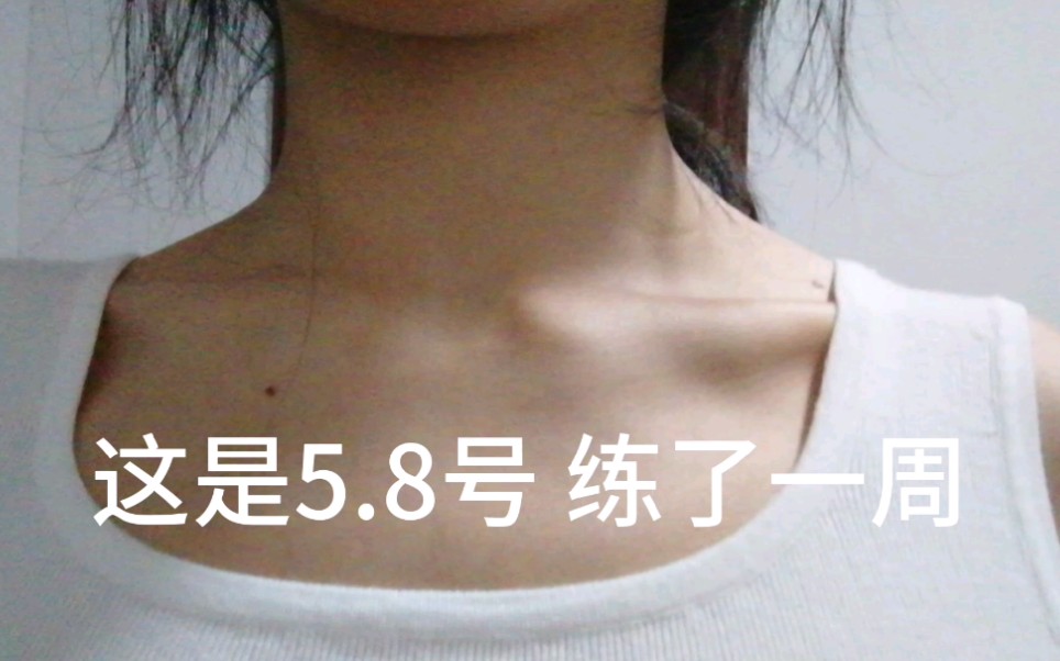 求助斜方肌鼓包有跟duke天鹅颈运动就是那个斜方肌拉伸的姐妹吗现在出