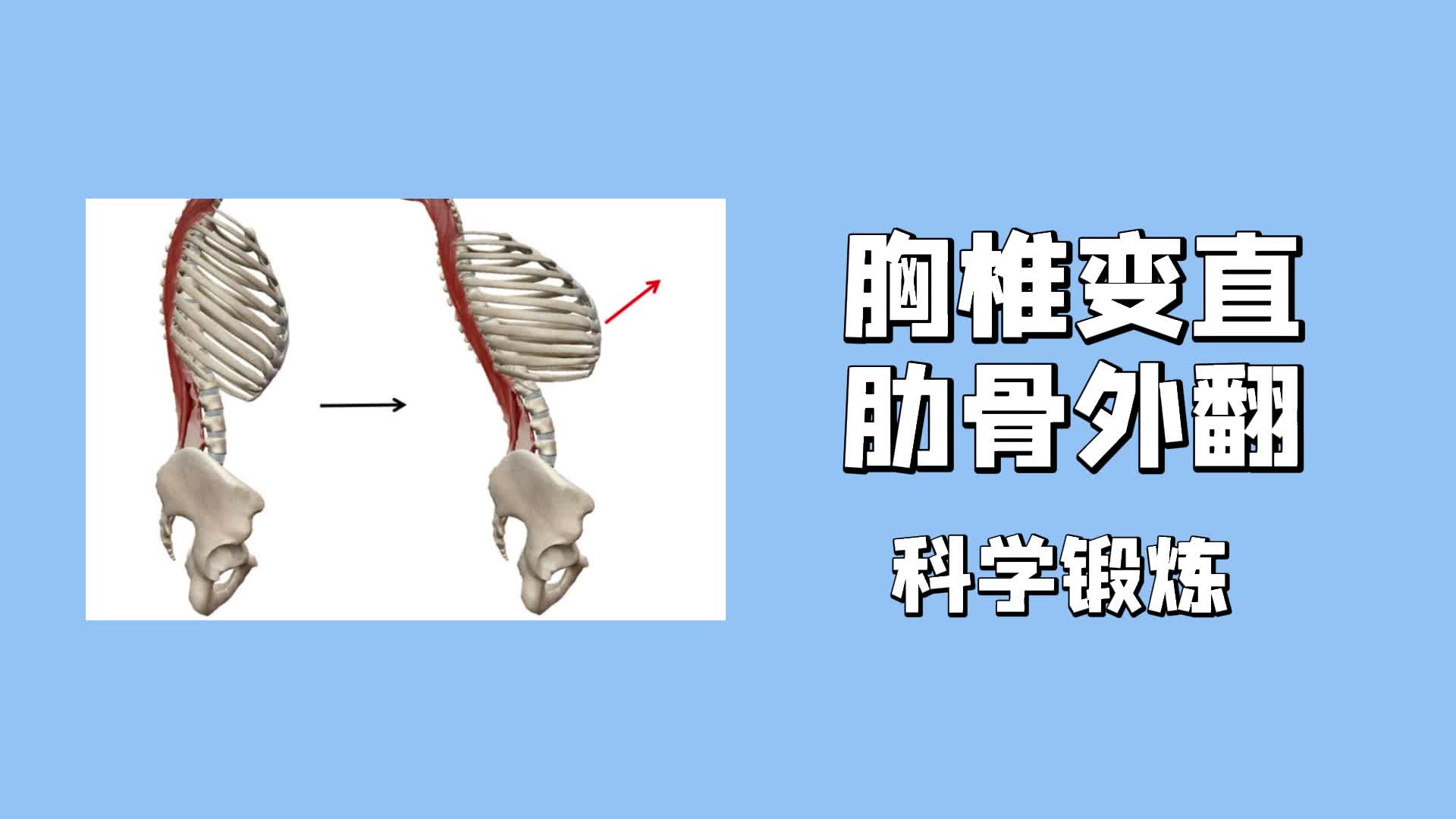 胸椎變直肋骨外翻怎麼辦