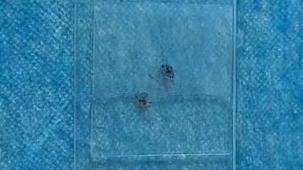 20秒第一视角带你体验阴虱在显微镜下的样子,新鲜出炉的小阴虱.