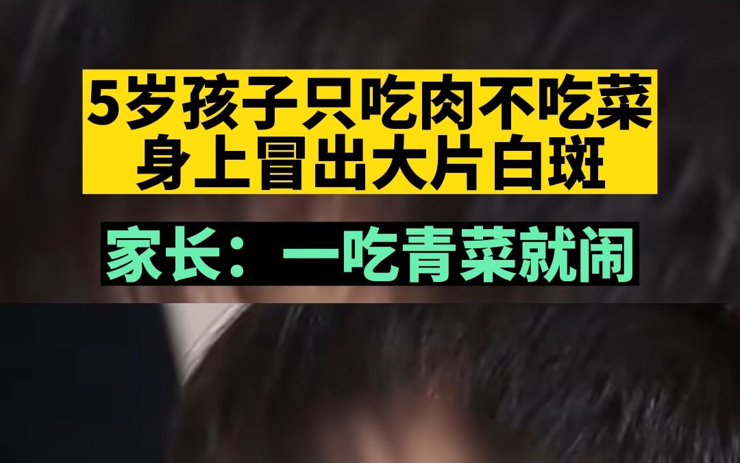 5岁孩子只吃肉不吃菜,身上出现大片白斑