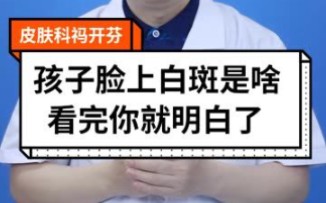 孩子脸上的白色斑块不一定是白癜风,看完这个视频你就明白了❗️❗️❗️哔哩哔哩bilibili