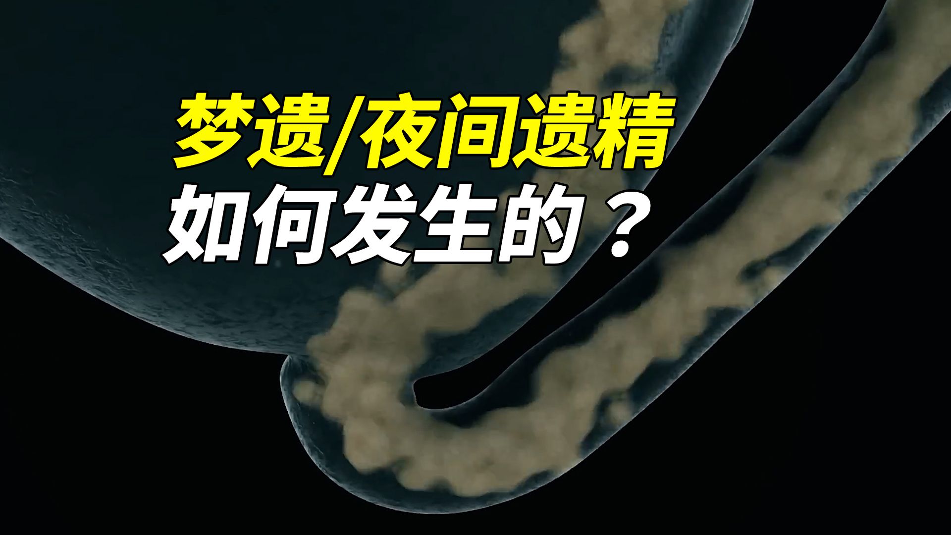 梦遗:男性青春期的奇妙体验,可遇不可求
