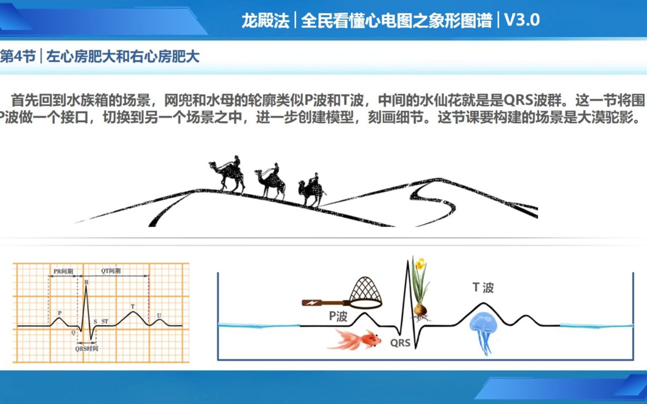 [图][15.04]第4节 左心房肥大和右心房肥大【龙殿法全民看懂心电图】助理执业医师实践技能操作适用满分开挂版V3.0