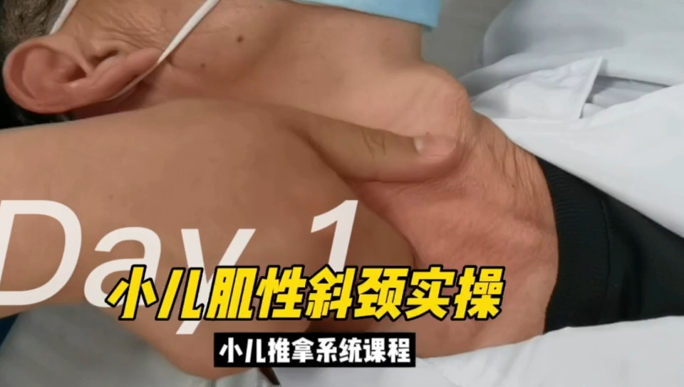 广州中医药大学王海宽老师教学小儿推拿-小儿肌性斜颈实操细讲