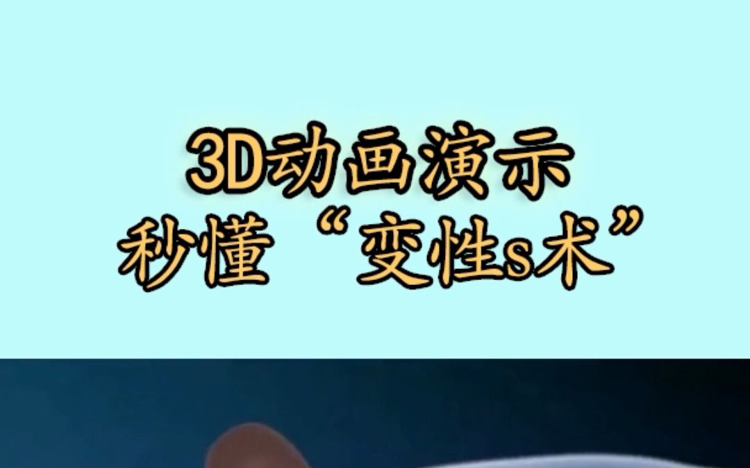 3D动画演示变性手术是怎么做的哔哩哔哩bilibili