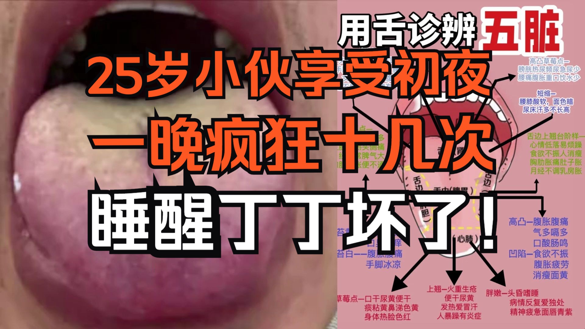 25岁小伙初尝禁果,一晚疯狂十几次,老二竟然废了!