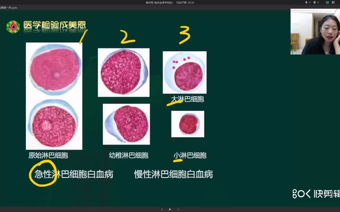 [图]急性淋巴细胞白血病，慢性淋巴细胞白血病——成美恩老师