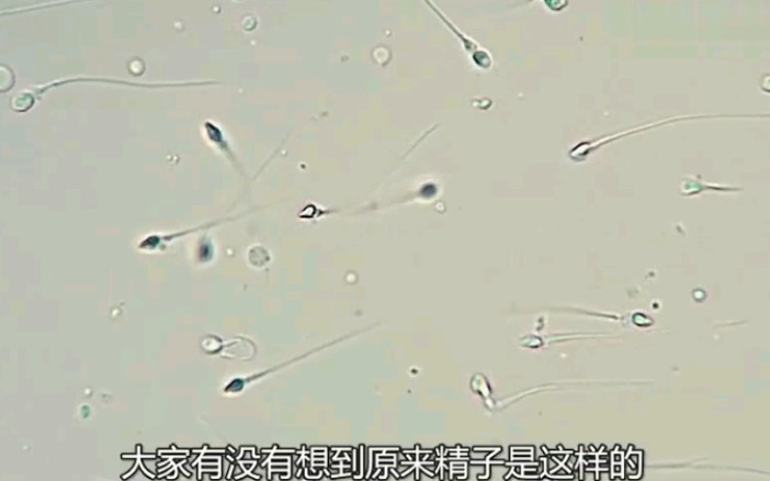 死精显微镜图片