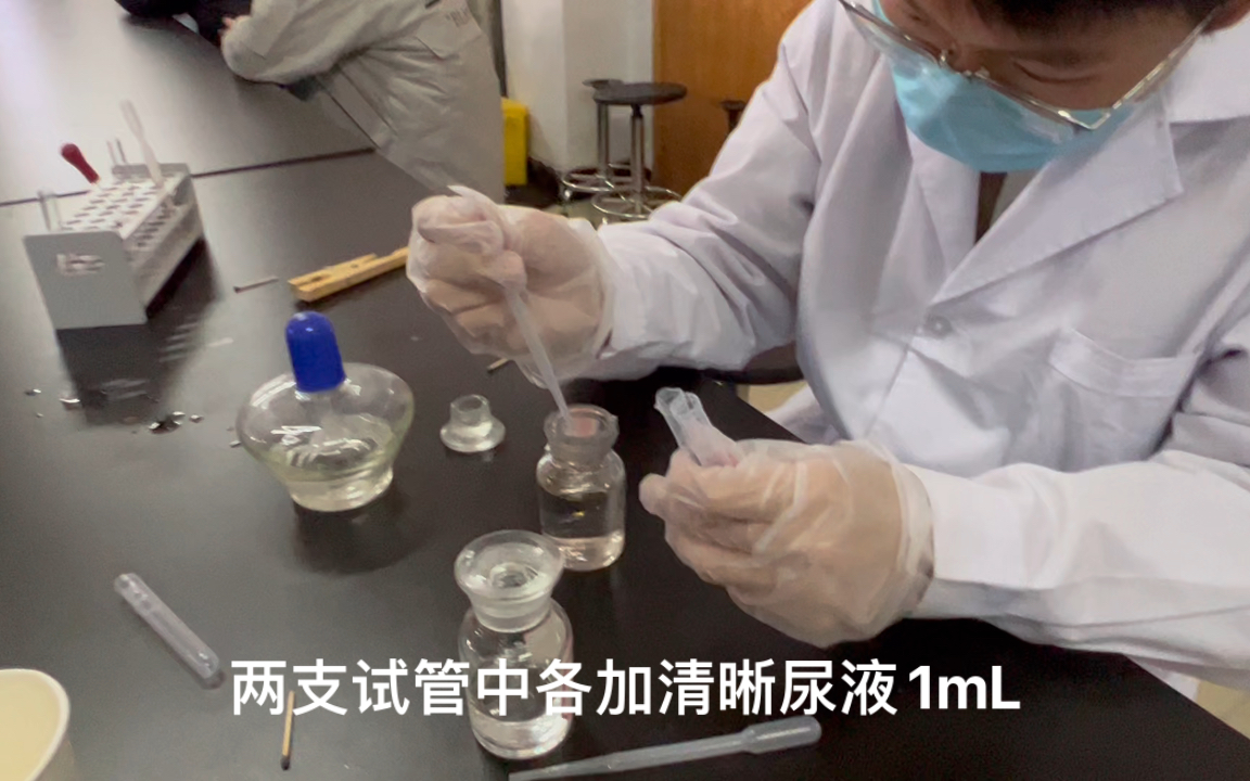 临床检验尿液蛋白质测定磺基水杨酸法