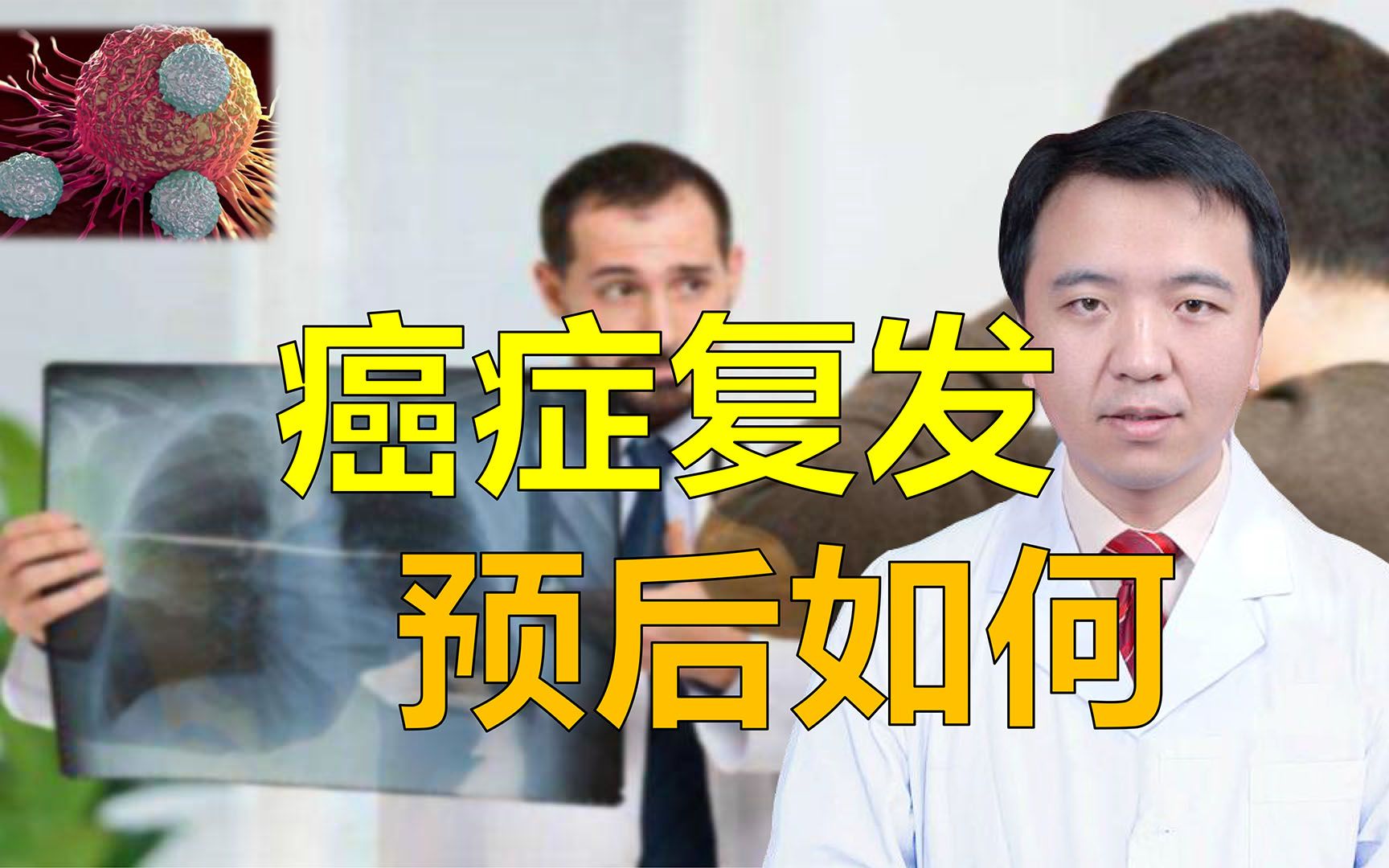 癌症患者复查发现肿瘤复发,复发就提示预后不好吗?医生:不一定哔哩哔哩bilibili