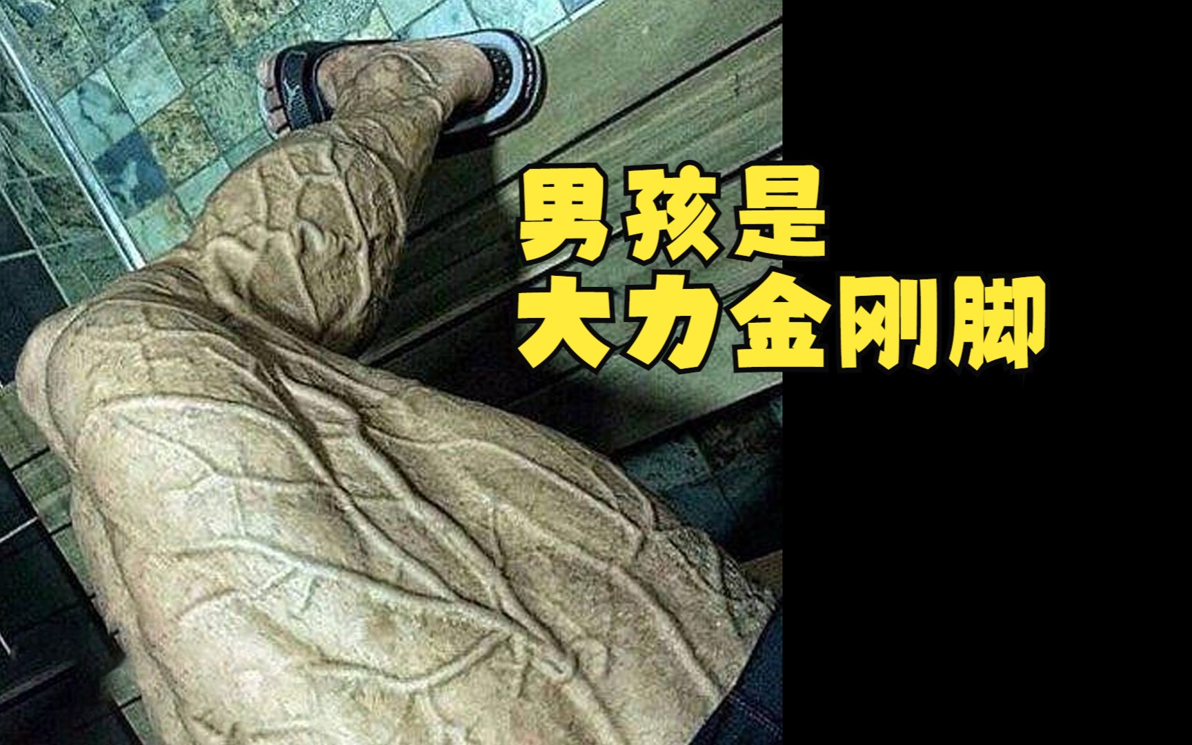 男孩天生不能动,却有一只大力金刚脚!哔哩哔哩bilibili