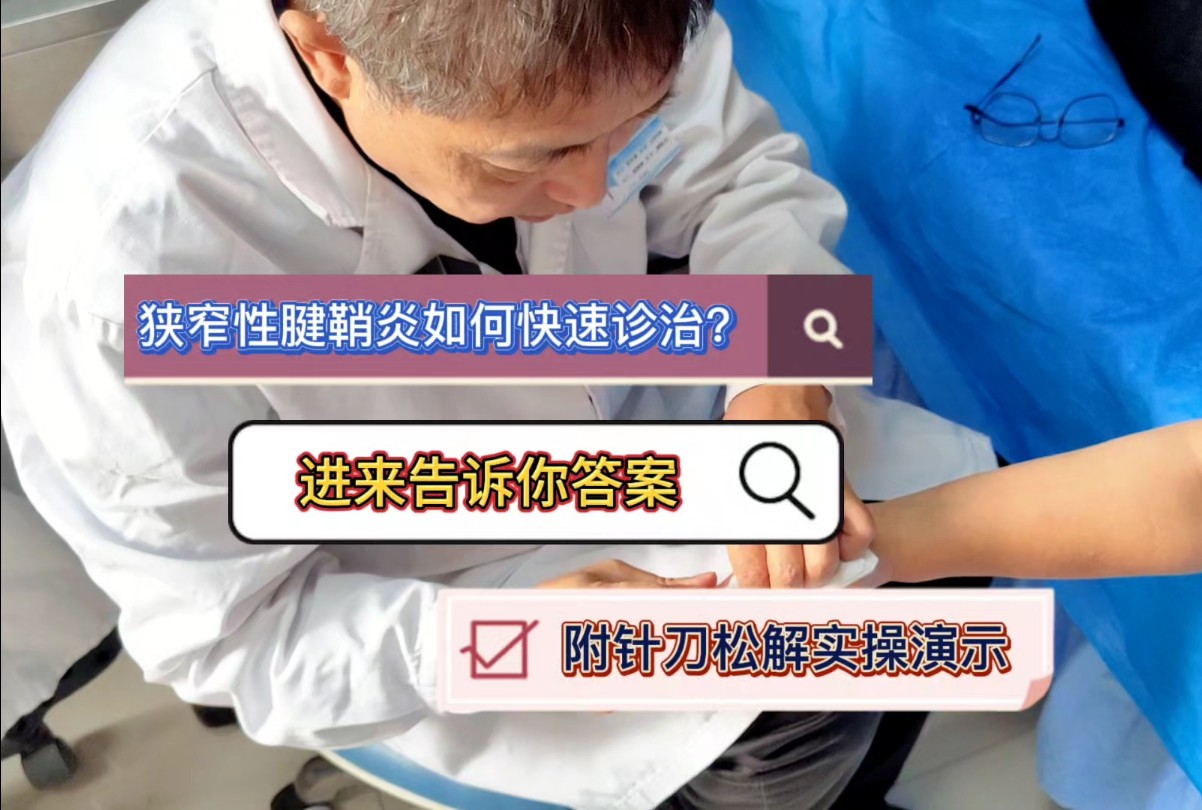 狭窄性腱鞘炎如何快速诊治?进来告诉你答案,附针刀松解实操演示哔哩哔哩bilibili