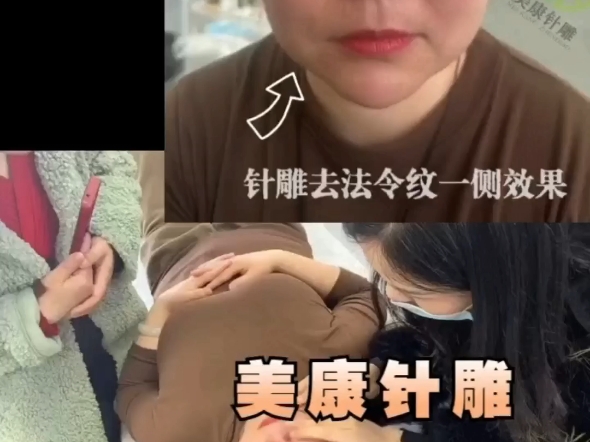 美康针灸美雕—国内起源地