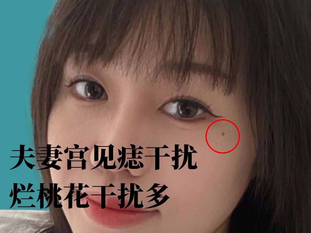 夫妻宫见痣.烂桃花干扰多
