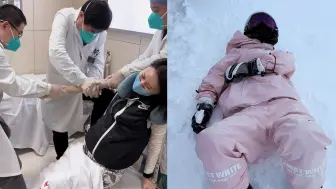 Скачать видео: 一女子滑雪骨折，骨科医生跳起为其接骨，网友：隔着屏幕都觉得痛