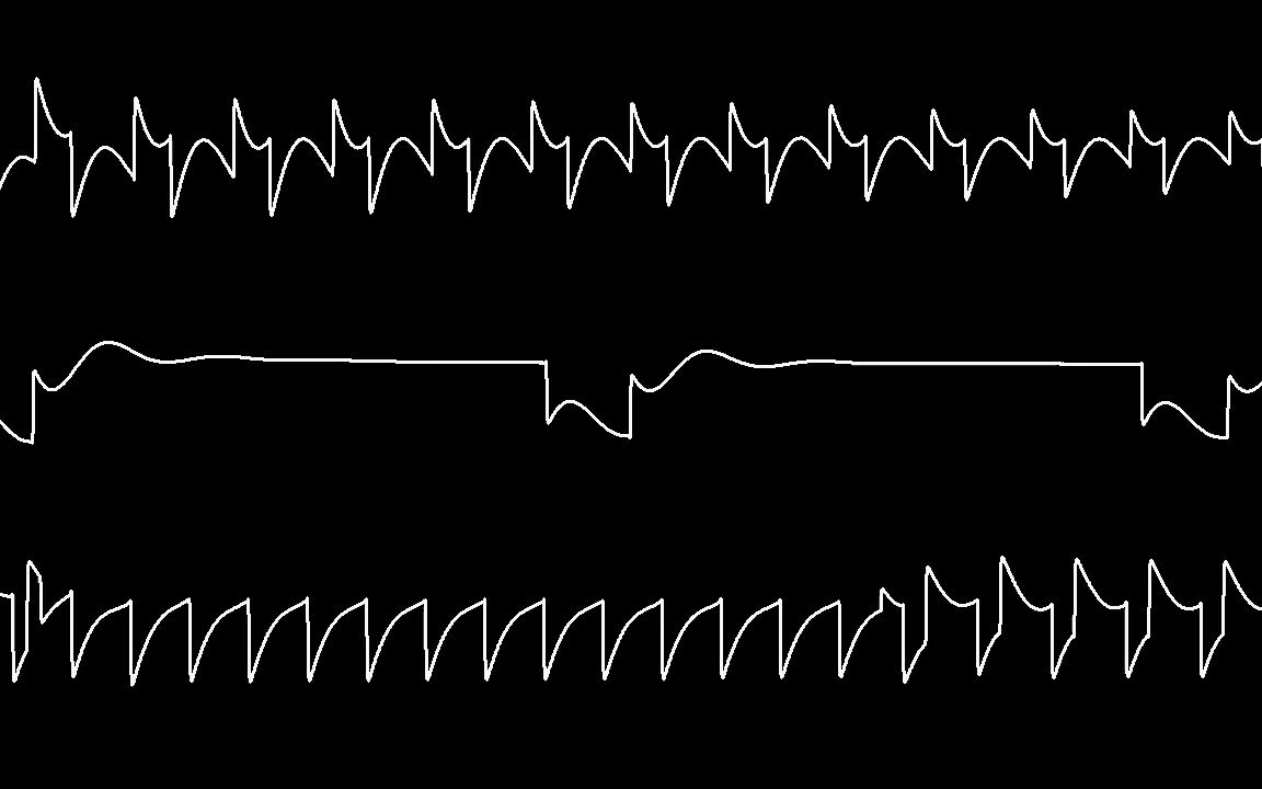 [图]C64 Jeroen Tel's -RoboCop 3- oscilloscope view