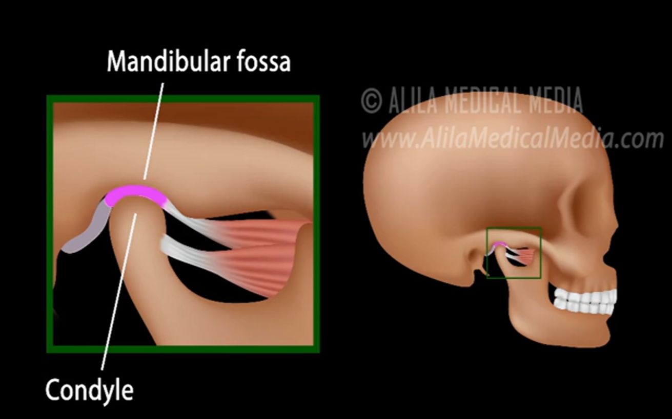 (中文字幕)3D动画演示颞下颌关节运动及关节盘移位原理哔哩哔哩bilibili