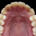 各种问题牙齿的矫正变化~看完了是不是也想做矫正了？