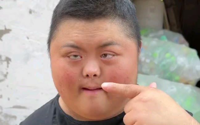 典中典之小鸭哥得了帕金森病