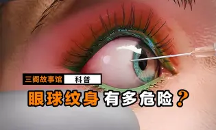 Descargar video: 危险的眼球纹身，后果太可怕了！