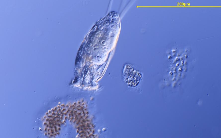 轮虫(三肢轮虫)口咽部的纤毛运动