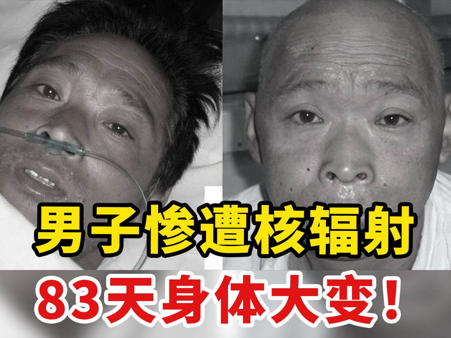 核污染有多可怕?日本男子83天的惨痛经历,揭露真实一面