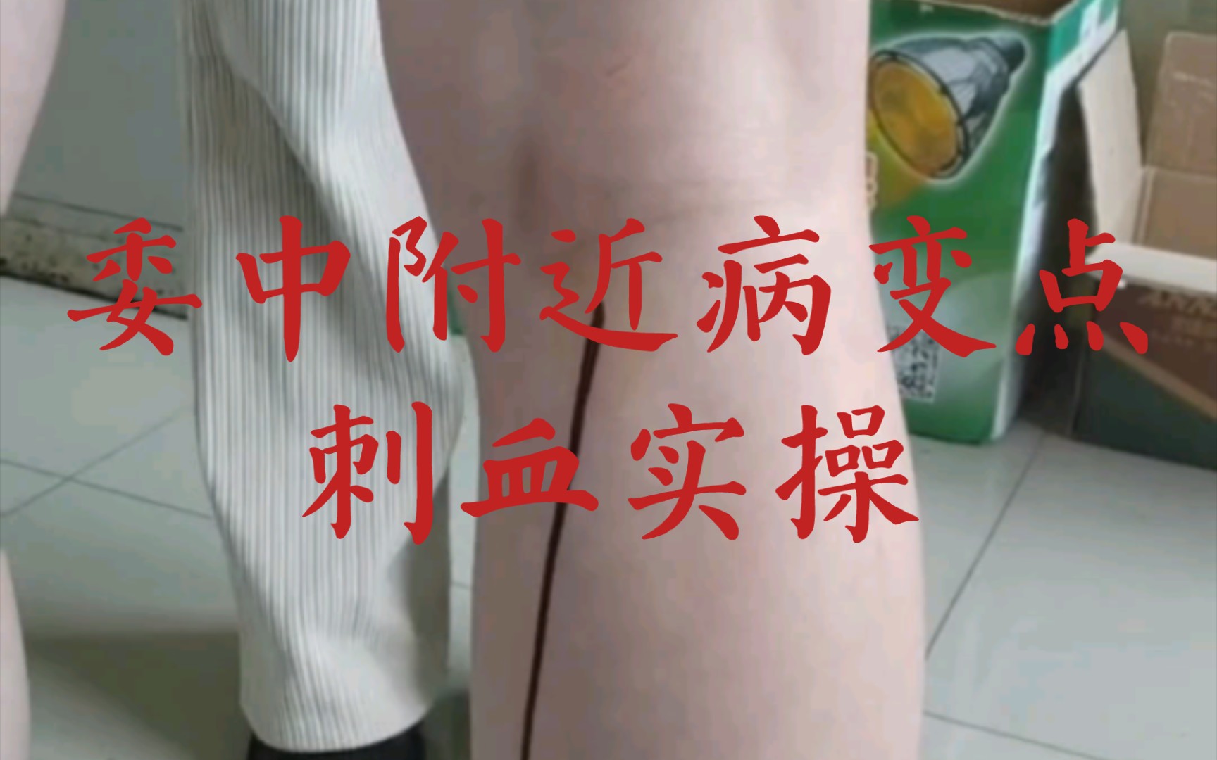 腰背委中求,肚腹三里留.哔哩哔哩bilibili