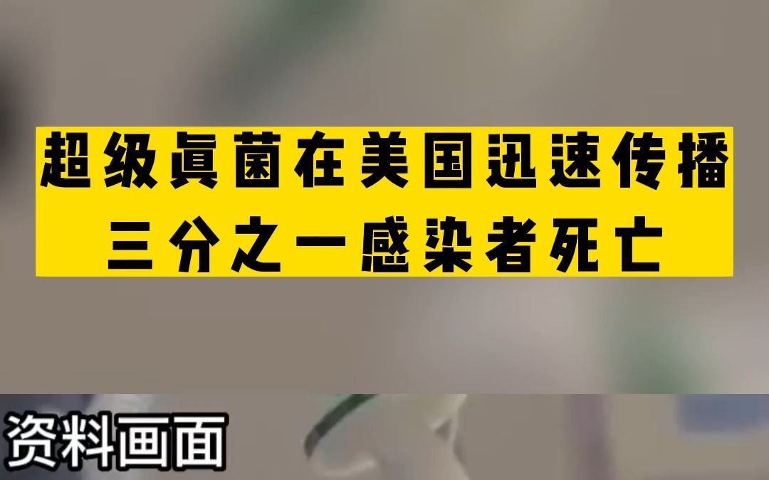 超级真菌在美国迅速传播,三分之一感染者死亡!哔哩哔哩bilibili