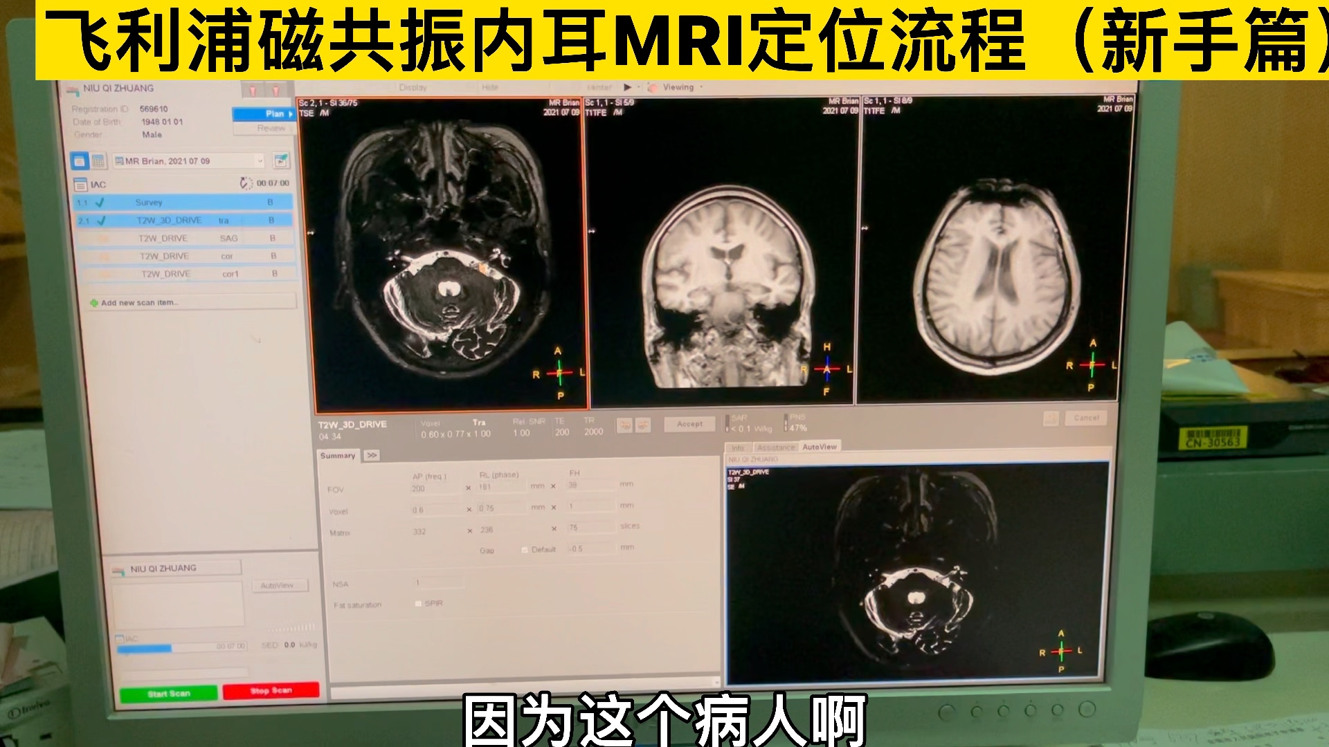 飛利浦磁共振內耳mri定位流程(新手篇)