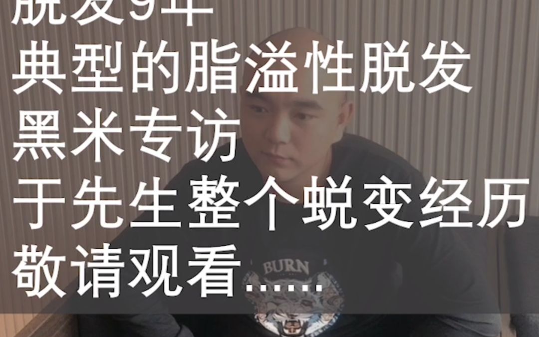 纹发是什么?黑米纹发哔哩哔哩bilibili