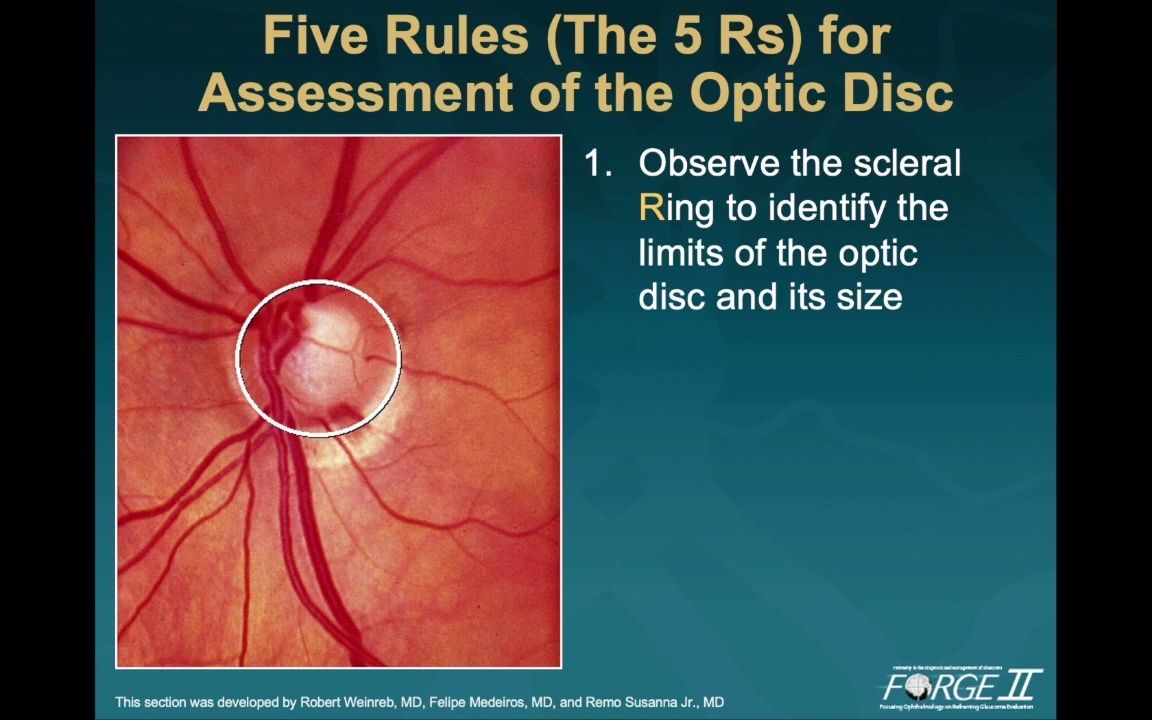 【中英双字】【视神经检查5R原则】The 5 Rs of Examining the Optic Disc (Malik Y. Kahook, MD)哔哩哔哩bilibili