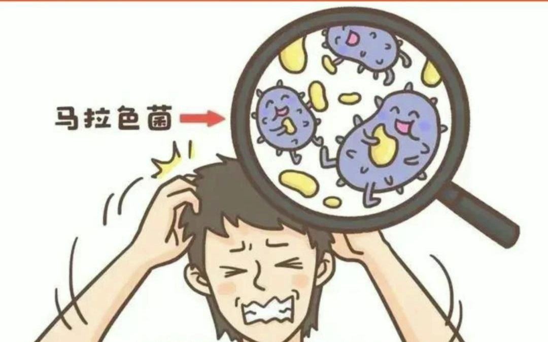 丝科慕四季头皮护理:头皮真菌感染会导致脱发吗?哔哩哔哩bilibili