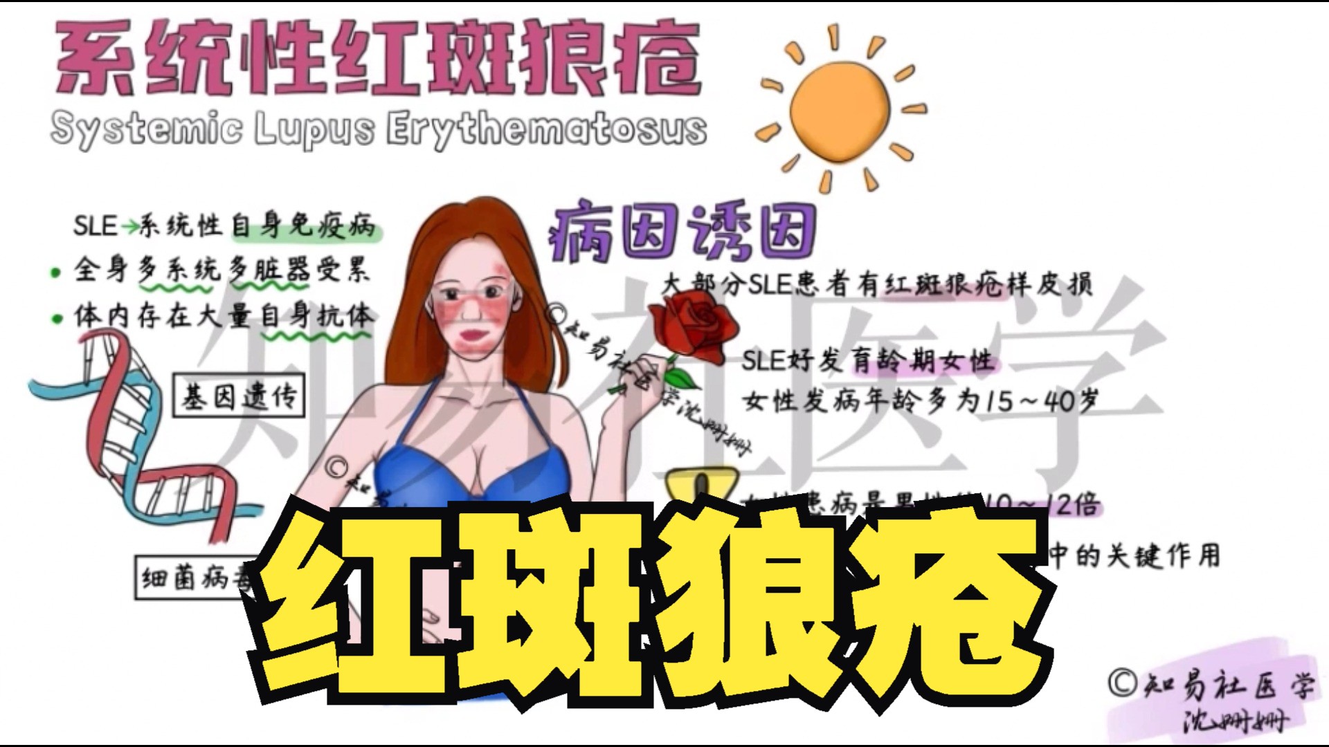 医学手绘 系统红斑狼疮(SLE)| 病因 发病机制 症状 诊断 治疗哔哩哔哩bilibili