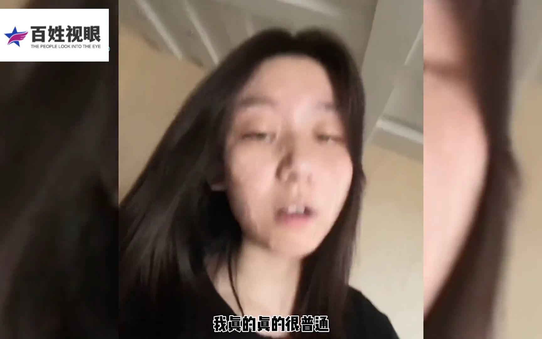 女孩意外受伤脸部受损,却依旧活得自信阳光,网友:你自信的样子最美.哔哩哔哩bilibili