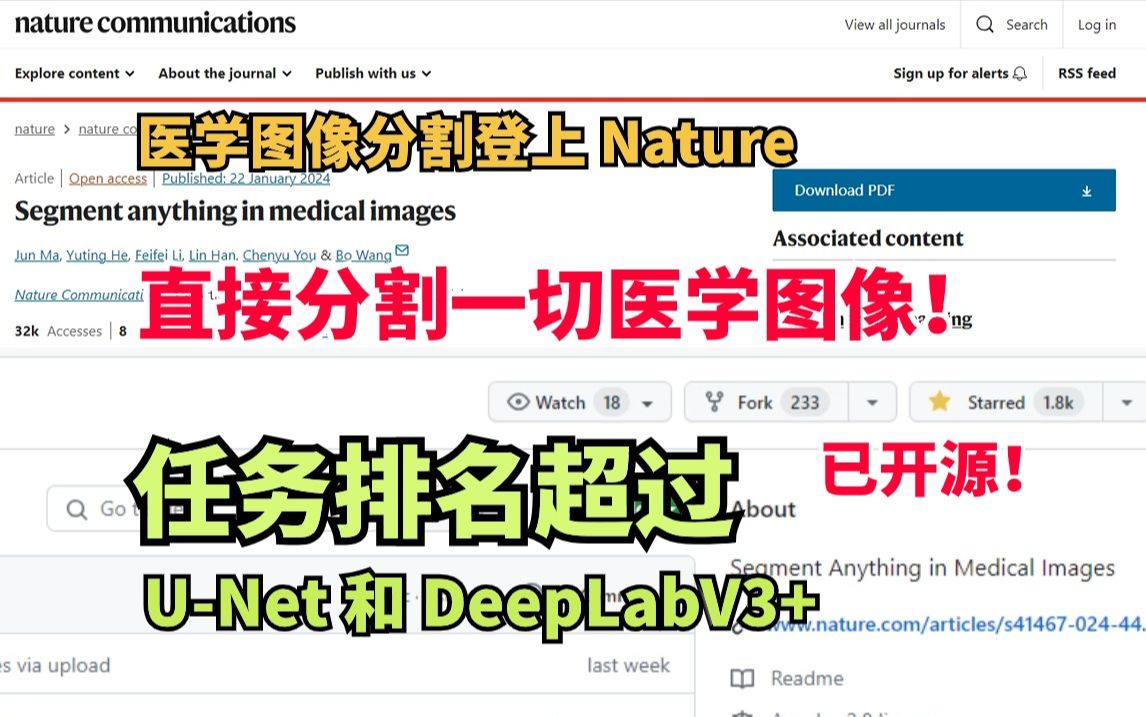 登上 Nature!这次直接分割一切医学图像!基于sam的医学图像分割模型深度学习/机器学习哔哩哔哩bilibili