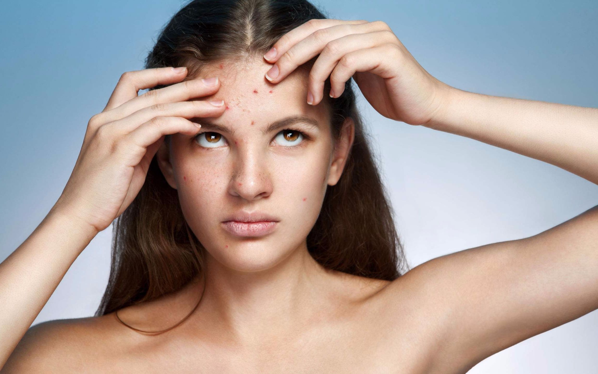 啪啪啪真的能治青春痘吗