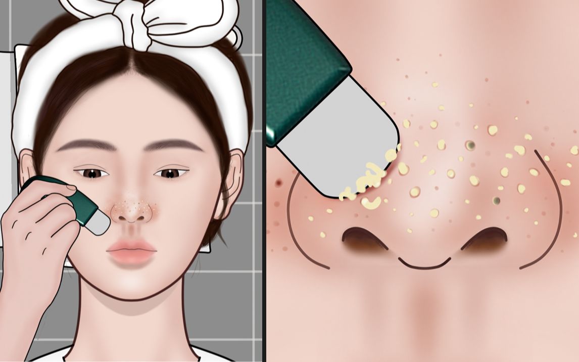 极度舒适!这样去黑头太解压了,鼻子直接干净细腻 | 萌大佬动画