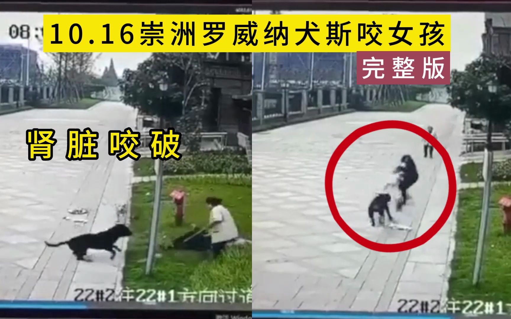 10.16成都崇州罗威纳犬咬人完整版,女孩肾脏被咬破哔哩哔哩bilibili