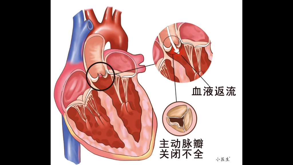 【医学美图】循环系统美图(来源于小医生) #张博士医考保定分校 #临床医学 #循环系统哔哩哔哩bilibili