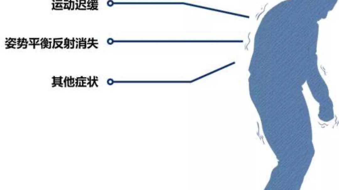 特发性震颤的症状