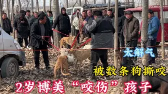 Download Video: 2岁博美护食咬伤孩子，大哥用8条猎犬对它进行疯狂撕咬，太残暴了