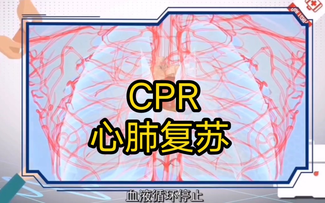 CPR心肺复苏术及AED使用动画演示哔哩哔哩bilibili