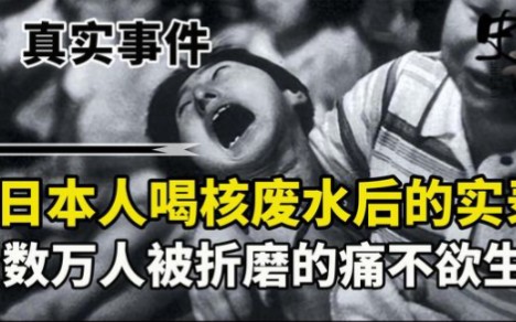 1953年,日本人喝过核废水后的真实画面,数万人被折磨的痛不欲生