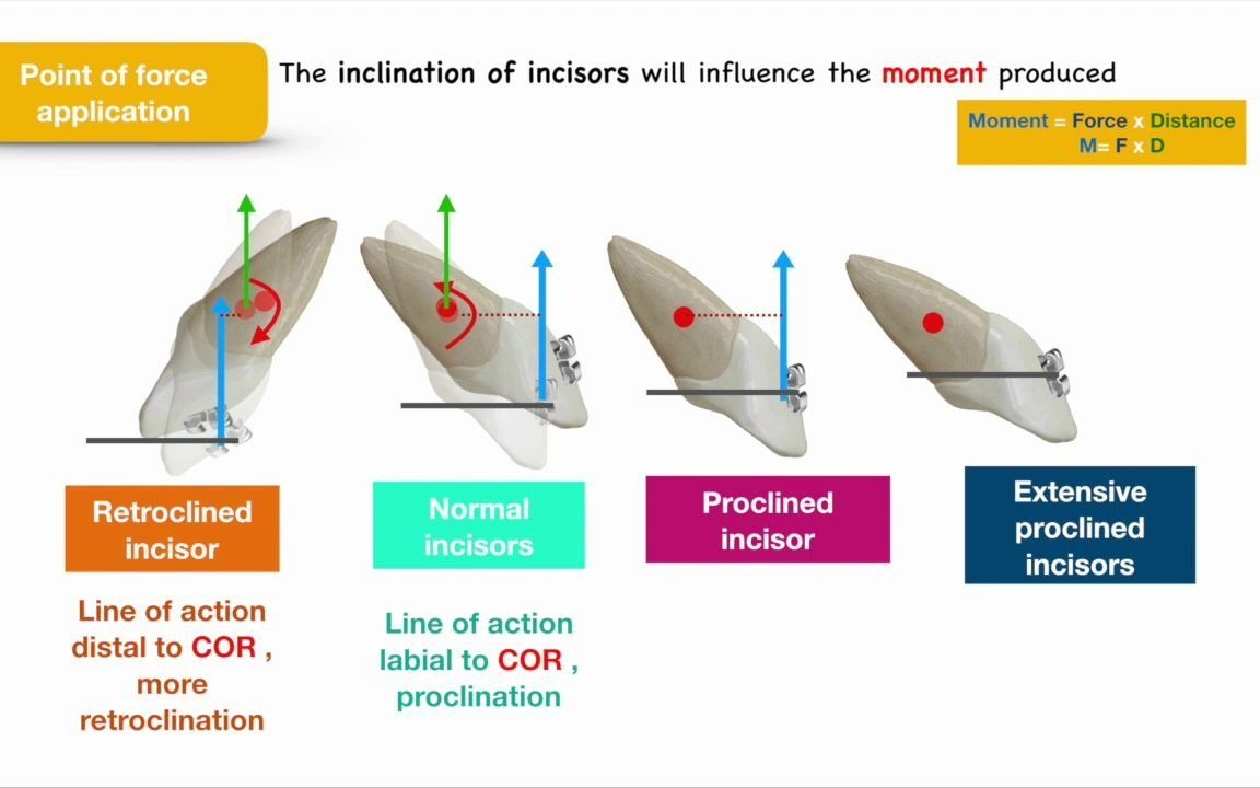 [图]Intrusion biomechanics