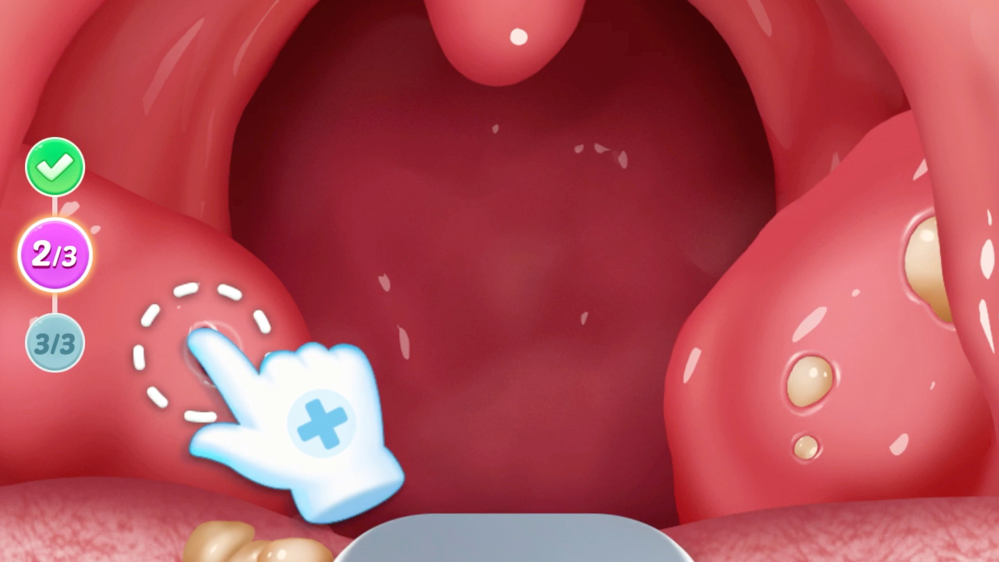 超解压,嗓子眼的颗粒挤光光