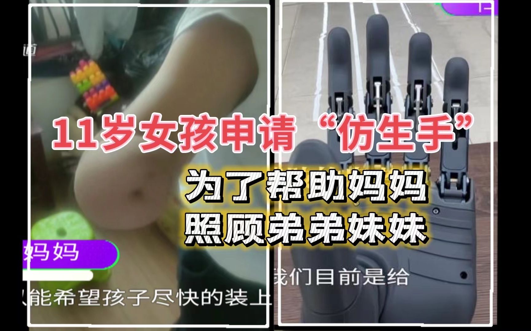 [图]11岁女孩申请第四例“仿生手”：有了手就可以帮妈妈照顾弟弟妹妹了…