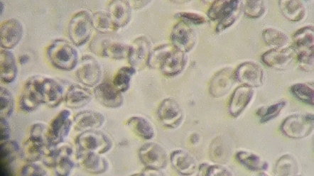 【细胞生物学实验】显微镜下 观察鸡红细胞的形态结构 药学生的日常哔哩哔哩bilibili